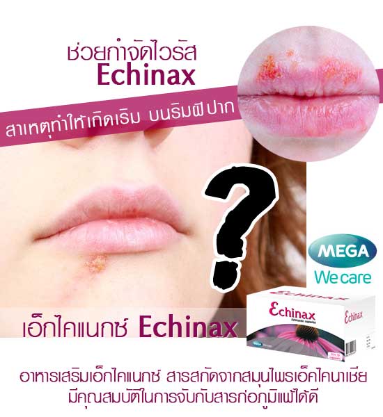 ECHINAX เป็นเริม นอนดึก และต้องดื่มเหล้า สมุนไพรเอ็คไคนาเชีย ช่วยฆ่าไวรัส
